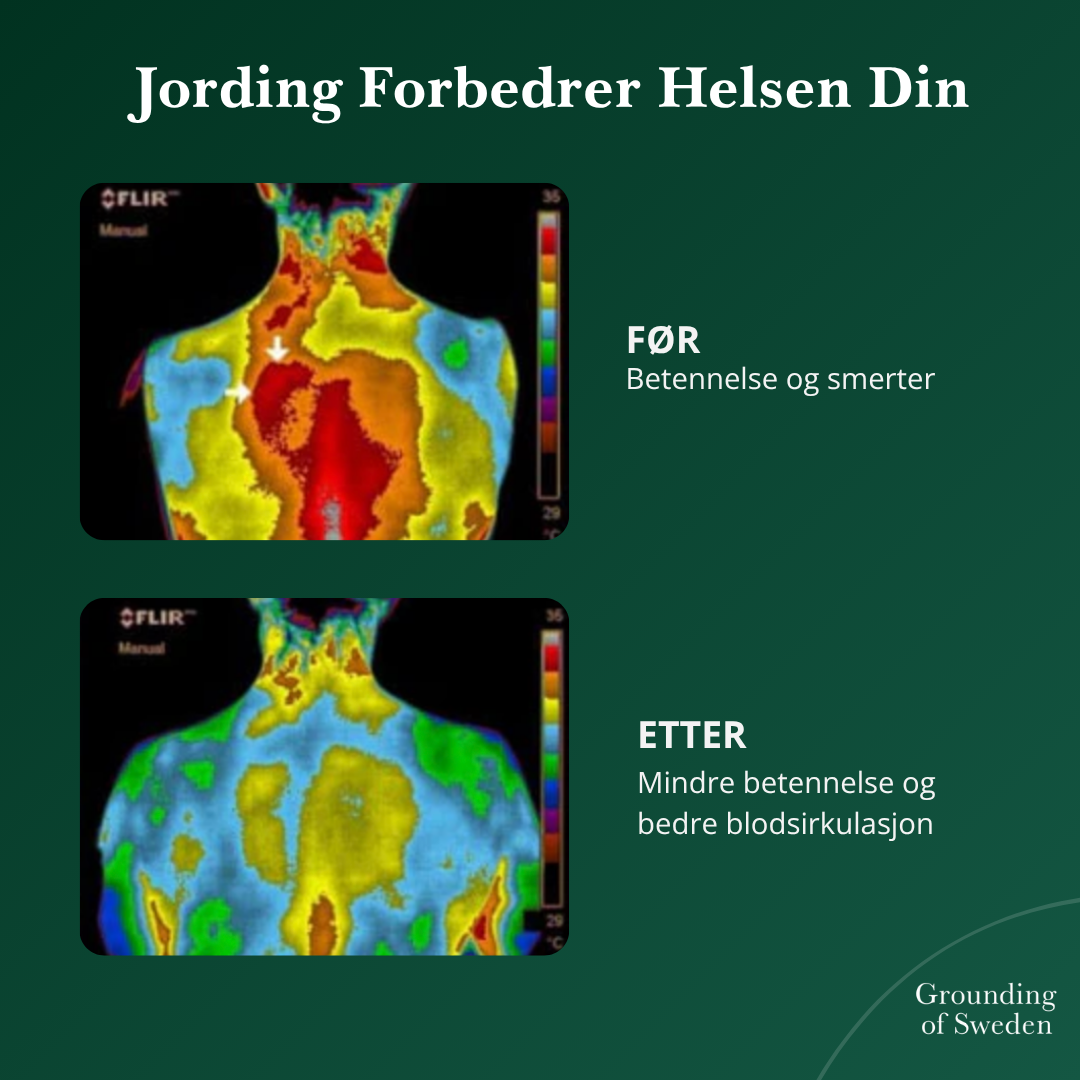 Føl Deg Best Hele Dagen Med Våre Jordingssko 2.0
